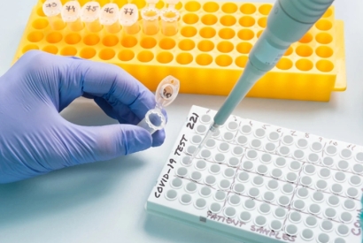 檢測(cè)試劑盒進(jìn)口清關(guān)公司代理資質(zhì)及手續(xù)流程